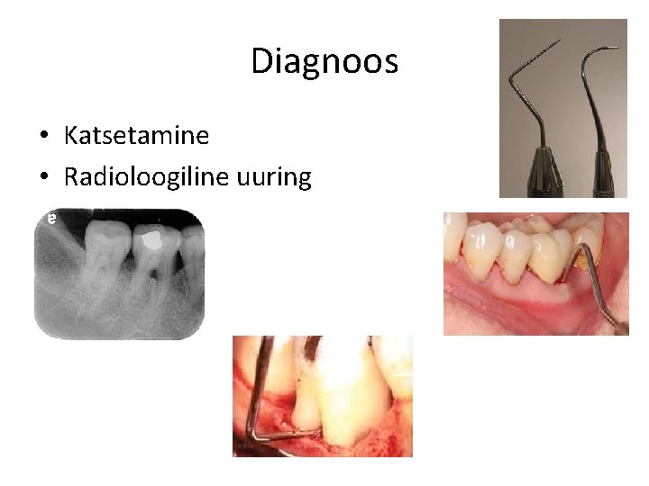 Diagnoos • Katsetamine • Radioloogiline uuring 