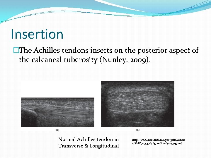 Insertion �The Achilles tendons inserts on the posterior aspect of the calcaneal tuberosity (Nunley,