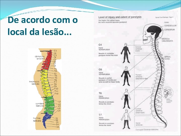 De acordo com o local da lesão. . . De acordo com o local da lesão. . .