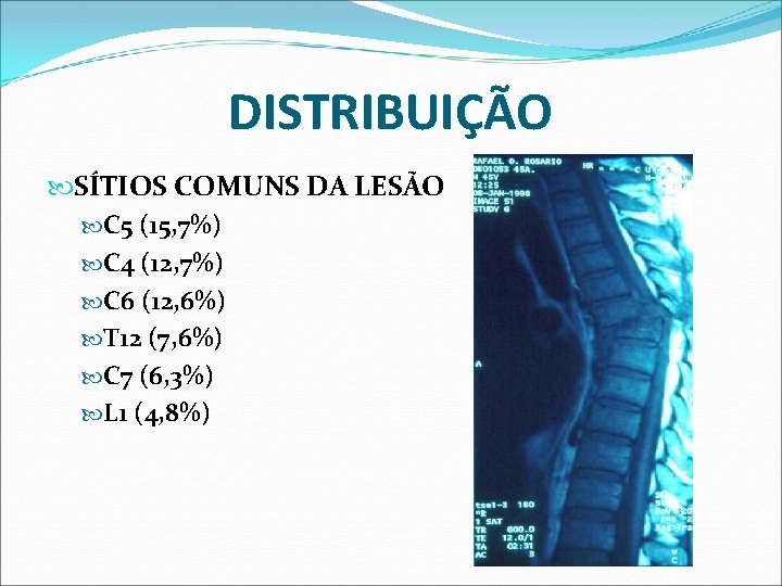 DISTRIBUIÇÃO SÍTIOS COMUNS DA LESÃO C 5 (15, 7%) C 4 (12, 7%) C DISTRIBUIÇÃO SÍTIOS COMUNS DA LESÃO C 5 (15, 7%) C 4 (12, 7%) C