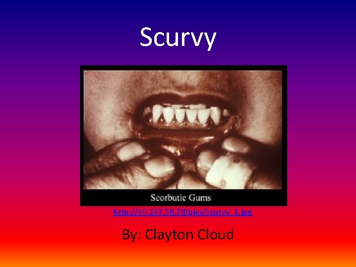 Scurvy http: //66. 197. 58. 78/pics/Scurvy_1. jpg By: Clayton Cloud 