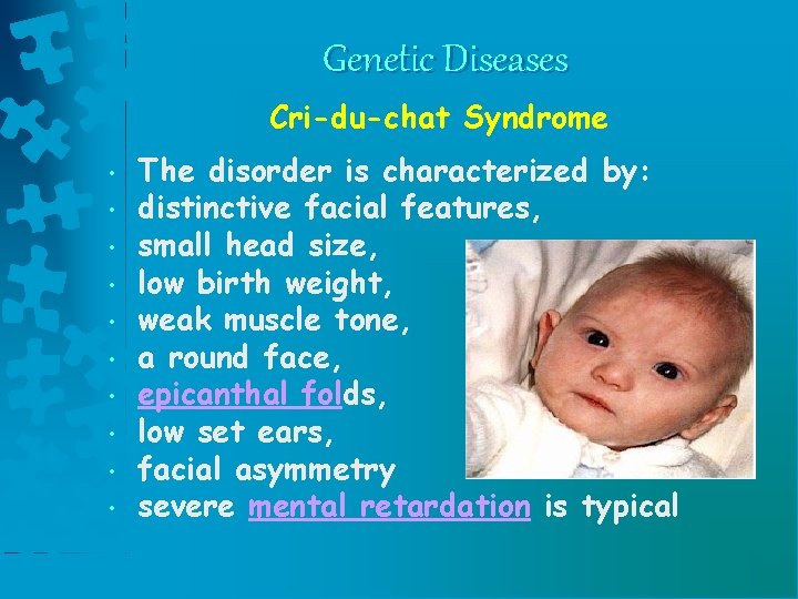 Genetic Diseases Cri-du-chat Syndrome • • • The disorder is characterized by: distinctive facial Genetic Diseases Cri-du-chat Syndrome • • • The disorder is characterized by: distinctive facial