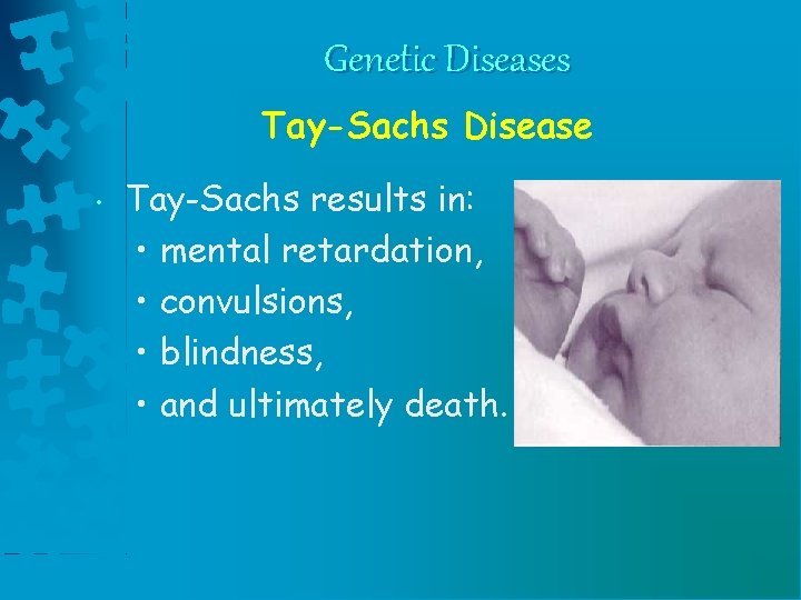 Genetic Diseases Tay-Sachs Disease • Tay-Sachs results in: • mental retardation, • convulsions, •