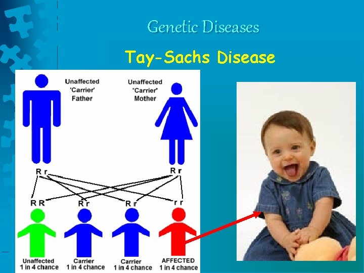 Genetic Diseases Tay-Sachs Disease Genetic Diseases Tay-Sachs Disease
