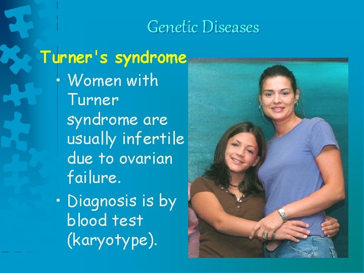 Genetic Diseases Turner's syndrome • Women with Turner syndrome are usually infertile due to Genetic Diseases Turner's syndrome • Women with Turner syndrome are usually infertile due to
