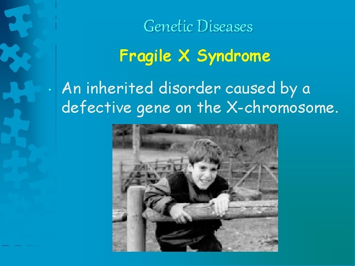 Genetic Diseases Fragile X Syndrome • An inherited disorder caused by a defective gene Genetic Diseases Fragile X Syndrome • An inherited disorder caused by a defective gene