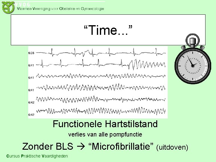 “Time. . . ” Functionele Hartstilstand verlies van alle pompfunctie Zonder BLS “Microfibrillatie” (uitdoven)