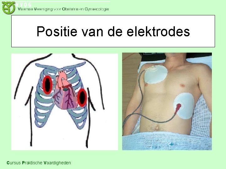 Positie van de elektrodes Cursus Praktische Vaardigheden 