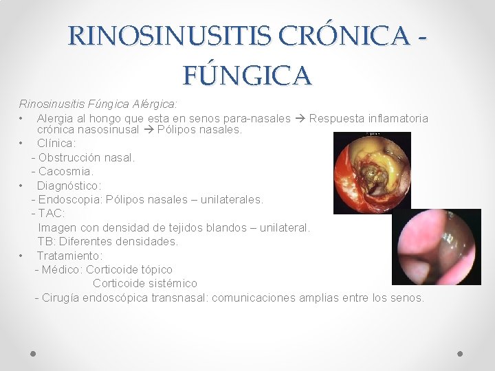RINOSINUSITIS CRÓNICA FÚNGICA Rinosinusitis Fúngica Alérgica: • Alergia al hongo que esta en senos