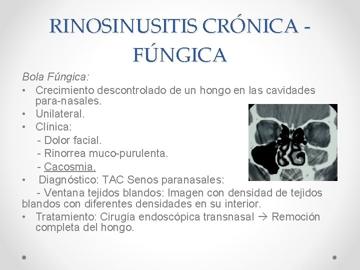 RINOSINUSITIS CRÓNICA FÚNGICA Bola Fúngica: • Crecimiento descontrolado de un hongo en las cavidades