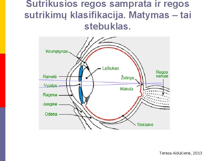 Sutrikusios regos samprata ir regos sutrikimų klasifikacija. Matymas – tai stebuklas. Teresa Aidukienė, 2013