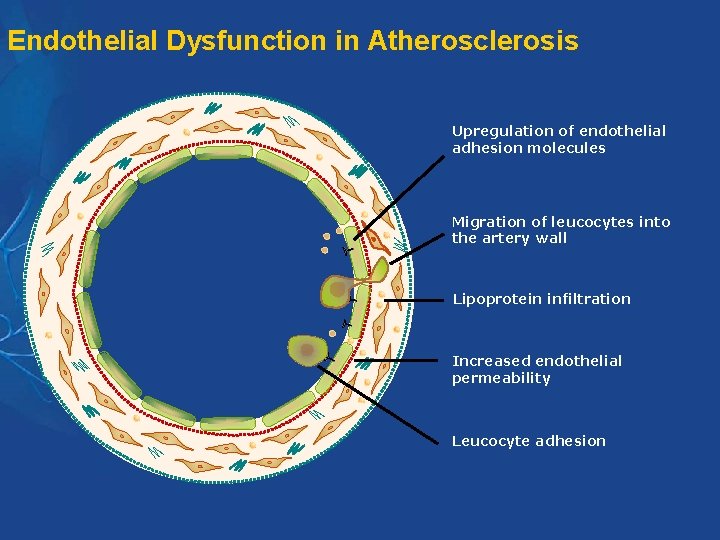 Endothelial Dysfunction in Atherosclerosis Upregulation of endothelial adhesion molecules Migration of leucocytes into the Endothelial Dysfunction in Atherosclerosis Upregulation of endothelial adhesion molecules Migration of leucocytes into the