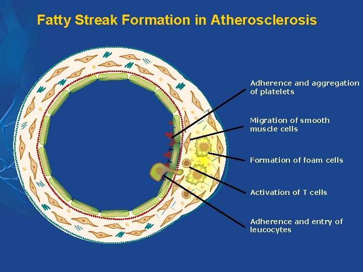 Fatty Streak Formation in Atherosclerosis Adherence and aggregation of platelets Migration of smooth muscle Fatty Streak Formation in Atherosclerosis Adherence and aggregation of platelets Migration of smooth muscle