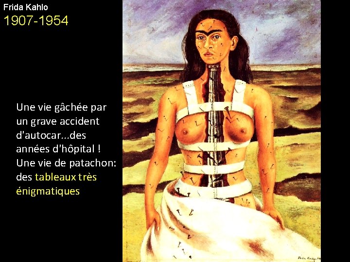 Frida Kahlo 1907 -1954 Une vie gâchée par un grave accident d'autocar. . .
