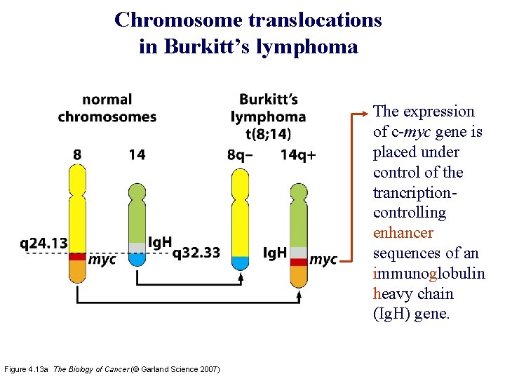 Chromosome translocations in Burkitt’s lymphoma The expression of c-myc gene is placed under control