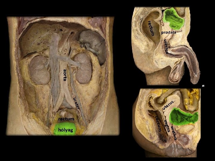 m rectu urethra aorta ut s ter ra ureth a vagin m rectu hólyag