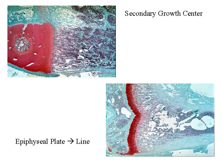 Secondary Growth Center Epiphyseal Plate Line 