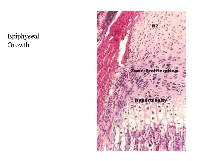 Epiphyseal Growth 