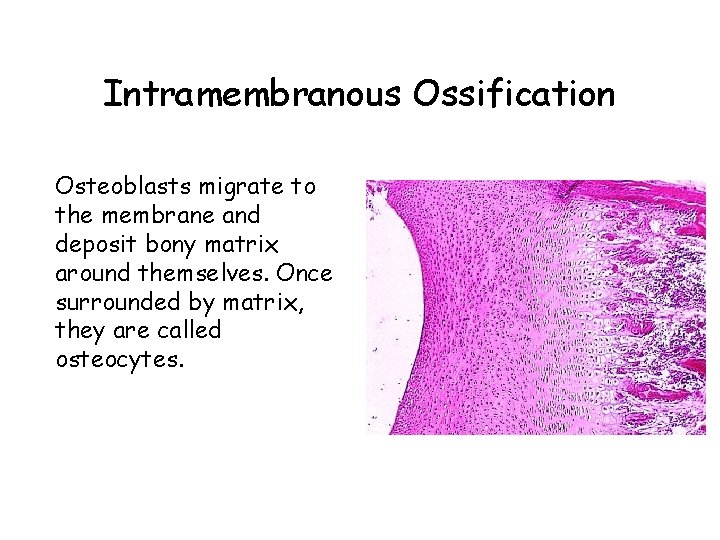 Intramembranous Ossification Osteoblasts migrate to the membrane and deposit bony matrix around themselves. Once