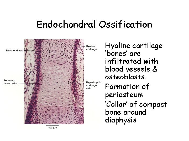 Endochondral Ossification • Hyaline cartilage ‘bones’ are infiltrated with blood vessels & osteoblasts. •
