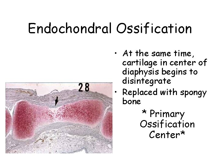 Endochondral Ossification • At the same time, cartilage in center of diaphysis begins to
