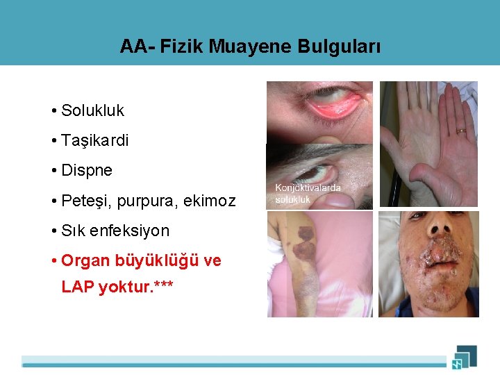 AA- Fizik Muayene Bulguları • Solukluk • Taşikardi • Dispne • Peteşi, purpura, ekimoz