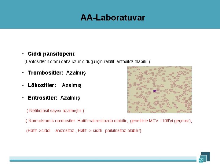 AA-Laboratuvar • Ciddi pansitopeni; (Lenfositlerin ömrü daha uzun olduğu için relatif lenfositoz olabilir )