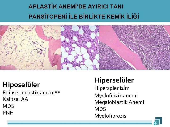 APLASTİK ANEMİ’DE AYIRICI TANI PANSİTOPENİ İLE BİRLİKTE KEMİK İLİĞİ Hiposelüler Edinsel aplastik anemi** Kalıtsal