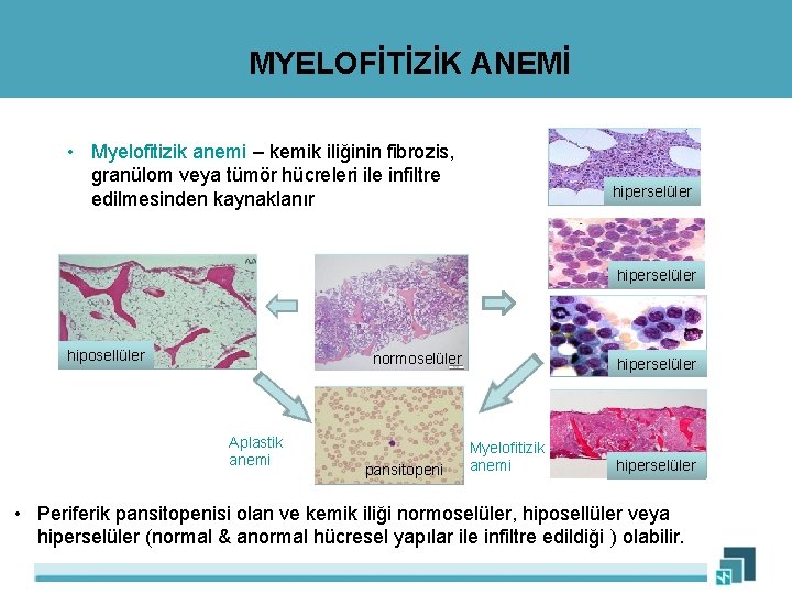 MYELOFİTİZİK ANEMİ • Myelofitizik anemi – kemik iliğinin fibrozis, Myelofitizik anemi granülom veya tümör