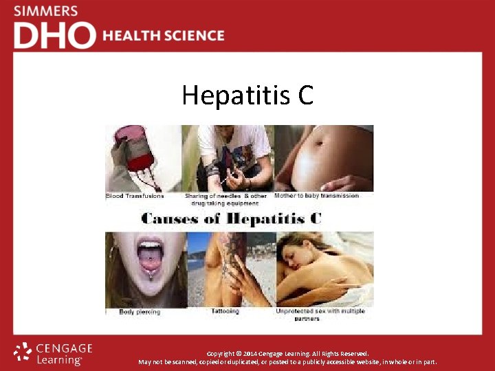 Hepatitis C Copyright © 2014 Cengage Learning. All Rights Reserved. May not be scanned,