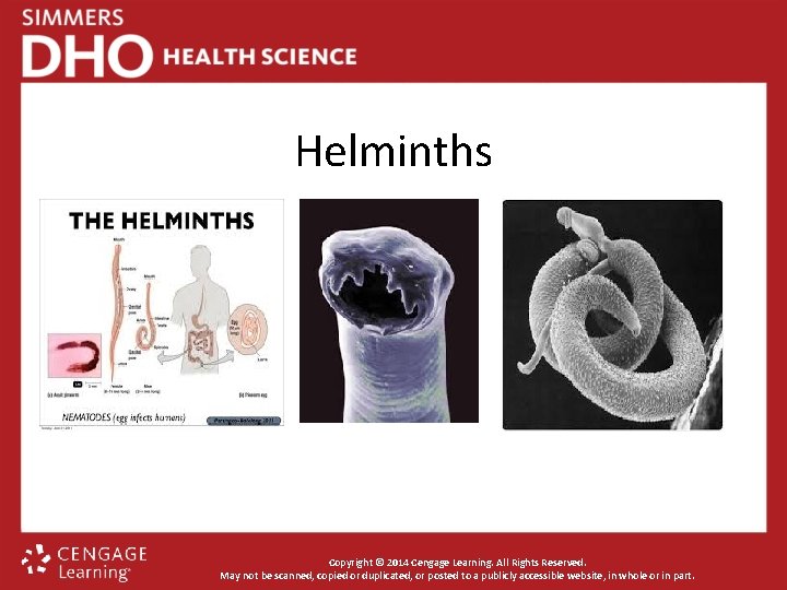 Helminths Copyright © 2014 Cengage Learning. All Rights Reserved. May not be scanned, copied