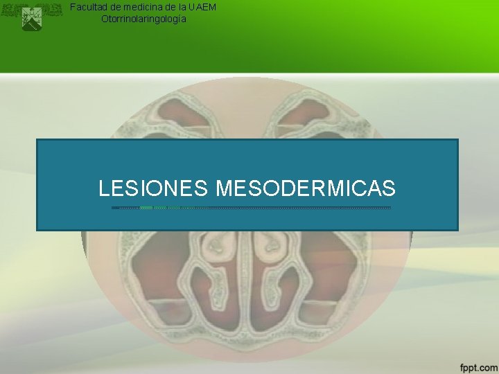 Facultad de medicina de la UAEM Otorrinolaringología LESIONES MESODERMICAS 