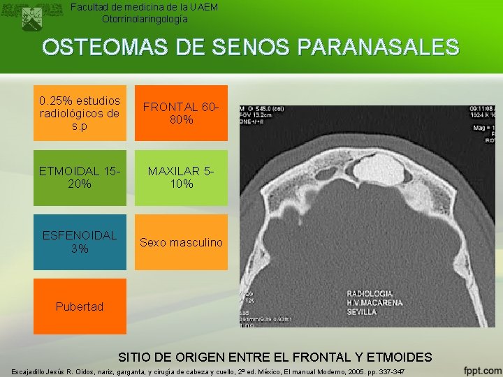 Facultad de medicina de la UAEM Otorrinolaringología OSTEOMAS DE SENOS PARANASALES 0. 25% estudios