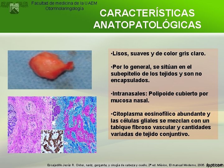 Facultad de medicina de la UAEM Otorrinolaringología CARACTERÍSTICAS ANATOPATOLÓGICAS • Lisos, suaves y de