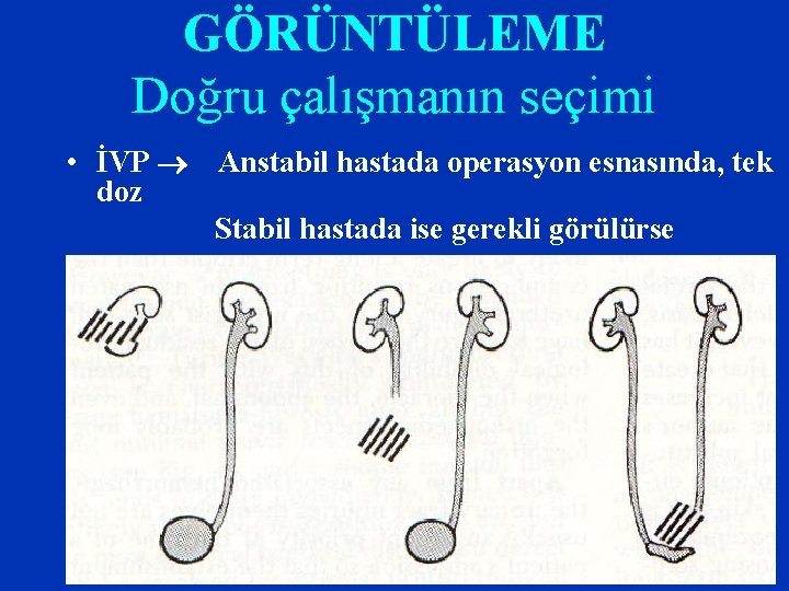 GÖRÜNTÜLEME Doğru çalışmanın seçimi • İVP Anstabil hastada operasyon esnasında, tek doz Stabil hastada