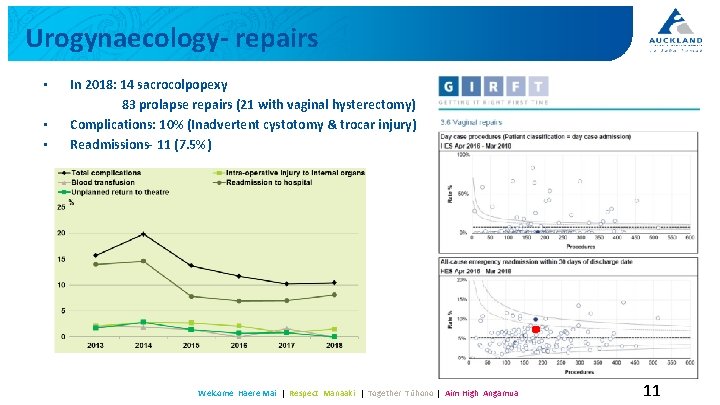 Urogynaecology- repairs • • • In 2018: 14 sacrocolpopexy 83 prolapse repairs (21 with