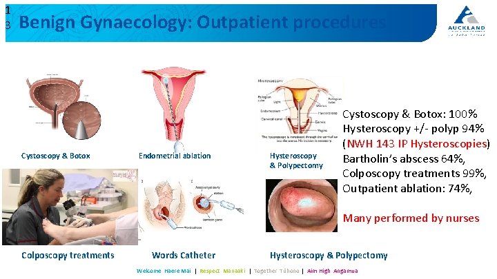 1 3 Benign Gynaecology: Outpatient procedures Cystoscopy & Botox Endometrial ablation Hysteroscopy & Polypectomy