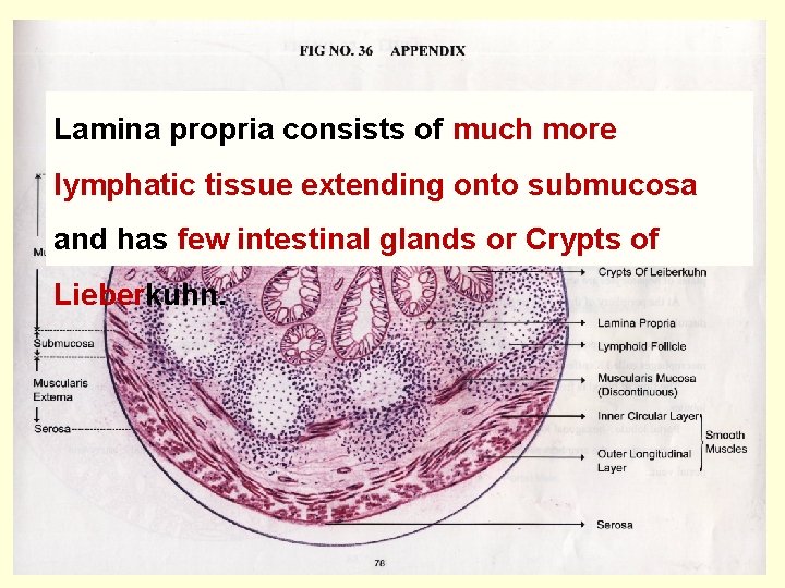 Lamina propria consists of much more lymphatic tissue extending onto submucosa and has few