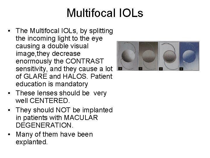 Multifocal IOLs • The Multifocal IOLs, by splitting the incoming light to the eye