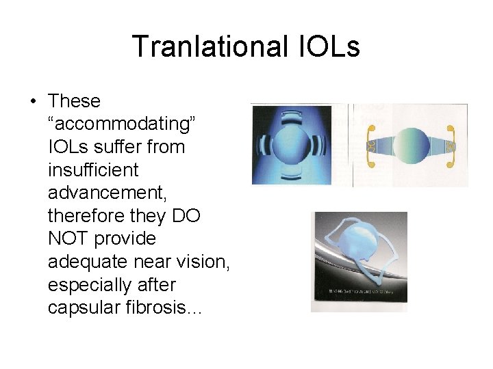 Tranlational IOLs • These “accommodating” IOLs suffer from insufficient advancement, therefore they DO NOT