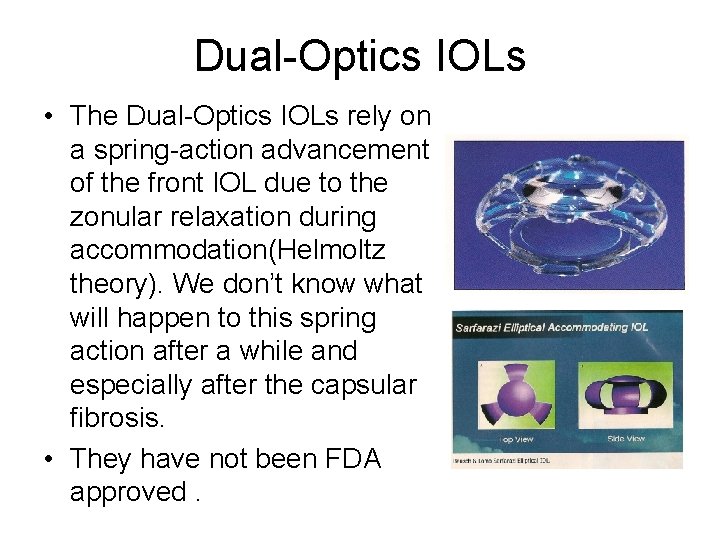 Dual-Optics IOLs • The Dual-Optics IOLs rely on a spring-action advancement of the front