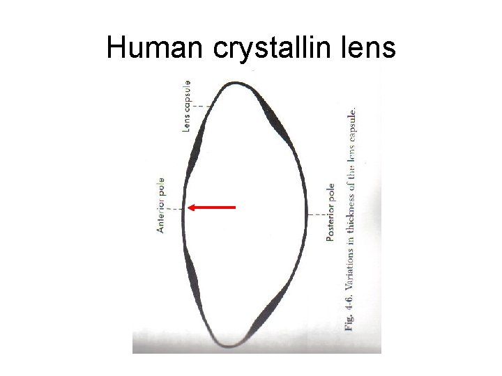 Human crystallin lens 