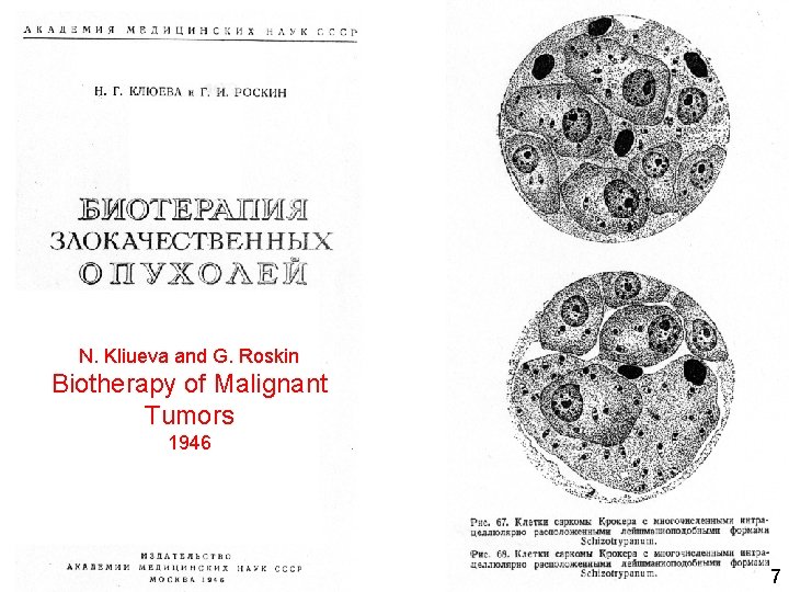 N. Kliueva and G. Roskin Biotherapy of Malignant Tumors 1946 7 