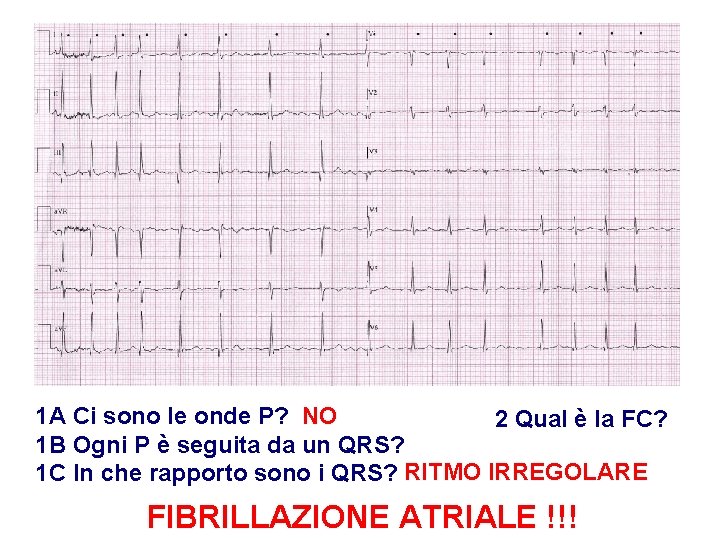 Advanced Cardiac Life Support Gruppo RCP ANMCO - ITO AHA 1 A Ci sono