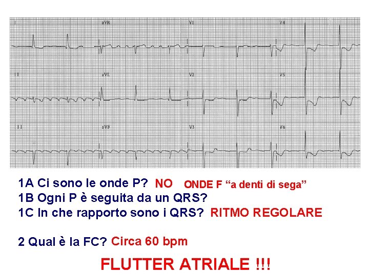 Advanced Cardiac Life Support Gruppo RCP ANMCO - ITO AHA 1 A Ci sono