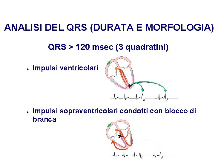 Advanced Cardiac Life Support Gruppo RCP ANMCO - ITO AHA ANALISI DEL QRS (DURATA