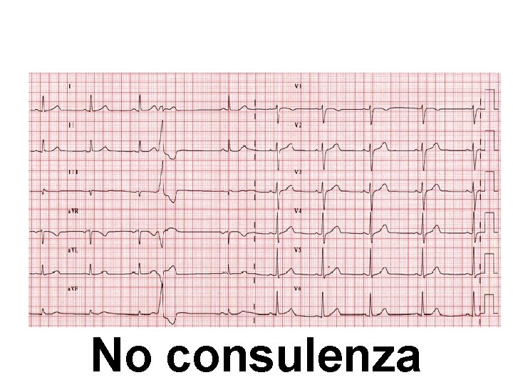 Advanced Cardiac Life Support Gruppo RCP ANMCO - ITO AHA No consulenza 