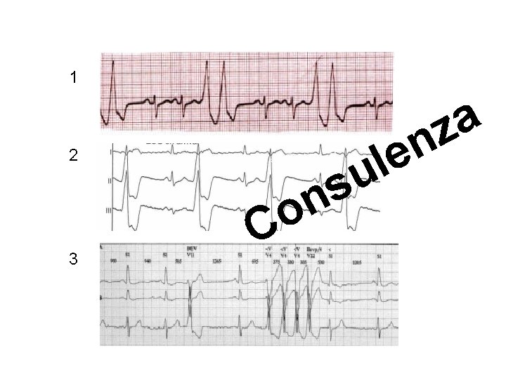 Advanced Cardiac Life Support Gruppo RCP ANMCO - ITO AHA 1 2 3 o