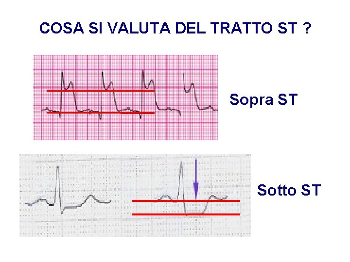 Advanced Cardiac Life Support Gruppo RCP ANMCO - ITO AHA COSA SI VALUTA DEL