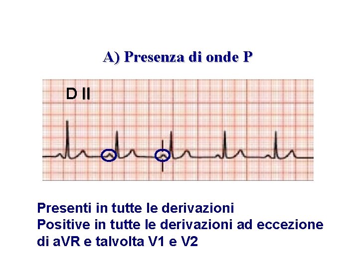 Advanced Cardiac Life Support Gruppo RCP ANMCO - ITO AHA A) Presenza di onde